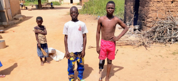 Twee Afrikaanse jongetjes waarvan één met een Ugani prothese