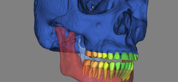 Tekening botten en tanden menselijk hoofd