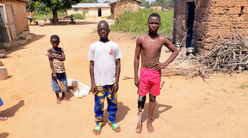 Twee Afrikaanse jongetjes waarvan één met een Ugani prothese